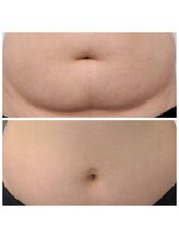 ビハダ(BeHADA)/#圧倒的なサイズダウン