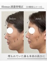 エレミュー(Elemue)/鼻が高く立体的に