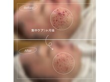 ハニー(Honey)の雰囲気（＼技術に自信あり／フェイシャル美肌、肌質改善、大人にニキビ）
