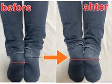 スッキリ整体院/骨盤矯正後の変化