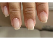 ラナムーン プティ(Lanamoon petit)/自爪矯正