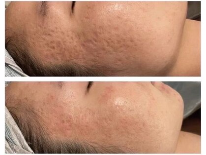 エクラ(e'clat)の写真