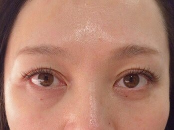 トミー(Tommy)/フラットラッシュ 120【60×60】