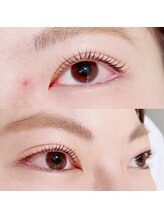 メリス(Mellis)/ラッシュリフト