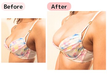 ピーグランディ 栄店(p-Grandi)/【お悩み】デコルテの削げと下垂