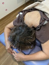 ワイズ 宜野湾鍼灸整骨院/頭痛、不眠改善に