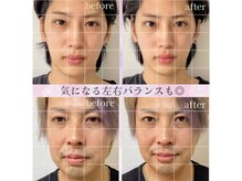 小顔整体 優の雰囲気（ほうれい線やたるみ改善★気になる左右バランスも◎）