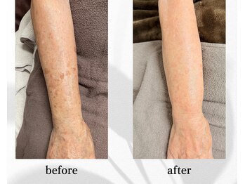 アン ビューティー(ann beauty)/リピーター様 70代