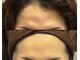リジェ(Rege)の写真/《徳島駅徒歩8分》再生美容で話題のエクソソーム専門の結果重視サロン♪5年先10年先を見据えたお肌作りを。