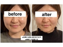 グリーン鍼灸整体院(green鍼灸整体院)