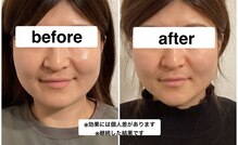 グリーン鍼灸整体院(green鍼灸整体院)