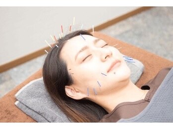 メディカルジャパン 表参道の写真/美容鍼で血液やリンパの流れを促進しリフトアップ効果♪お顔の筋肉をほぐして美肌・小顔へ導きます♪