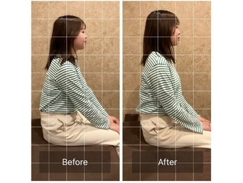 トラスト整体院 小池院/20代/女性/会社員/猫背