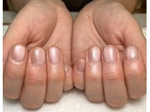 ブルーム(Bloom)/マグネットワンカラー