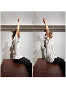 はぴねす鍼灸整骨院 飯田橋サクラテラス院/【飯田橋】施術変化1回