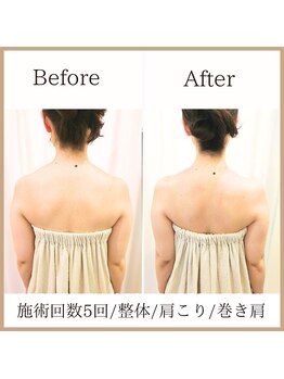 サロンルーチェ(Salon Luce)/30代ビフォーアフター/施術9回