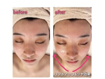 ビナリモア(B.enari-Moa)/若いかたにおすすめです！