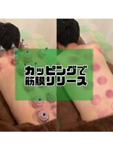 イチョウカイドウ いちょう街道整骨院(ICHO KAIDO)/カッピングで筋膜リリース