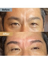 眉毛ハウス 吉祥寺店(眉毛HOUSE)/お客様の施術例(吉祥寺/東京)