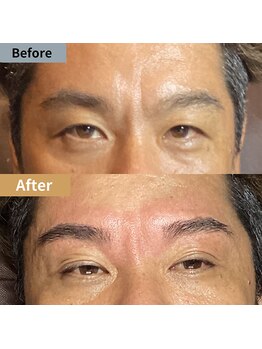 眉毛ハウス 吉祥寺店(眉毛HOUSE)/お客様の施術例(吉祥寺/東京)