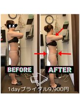 アンドユー カゴシマ(&you kagoshima)/ダイエット・1dayブライダル