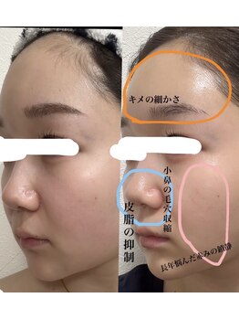 リノアンド(Lino&)/スキンケアの見直し