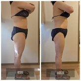 フォーエリミスプラス(for elims+)