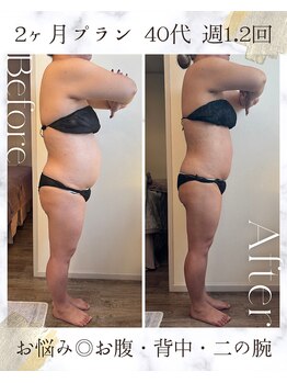 エヌア(nA)/2ヶ月プラン♪週1、2回ご来店◎