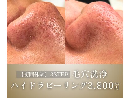 ティーナ(Teena)の写真