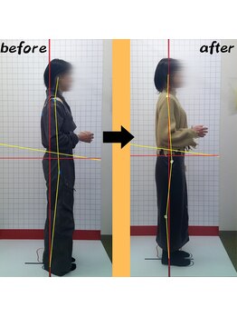 ほねつぎ 荒川沖はりきゅう接骨院/姿勢の変化1