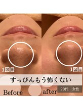 パルティノ 高崎店/加工で胡麻化すのを辞めたい