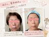 【隙間時間で肌管理】ミプラスショット★即メイクOKで帰宅