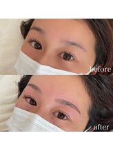 ダリ(Dali)/ハリウッドブロウリフト