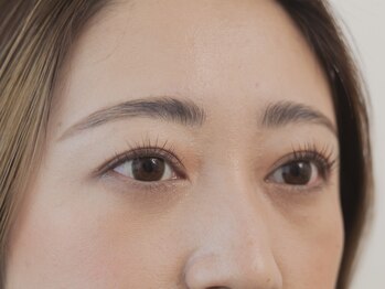 マハロ(mahalo)/≪HBL≫施術５