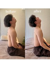 ハリノヒ 大阪院/ストレートネック改善鍼灸整体