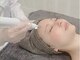 サロンステラ(SALON STELLA)の写真/【シミケア】薄いのも濃いのもお任せください♪お得な全顔打ち放題！コンシーラー卒業しませんか？