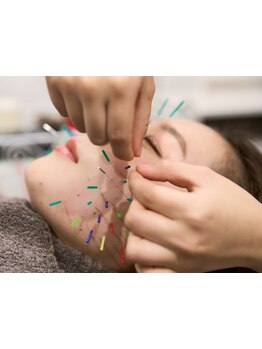 鍼灸施術を受けたい