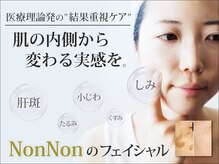 ノンノン(NonNon)の雰囲気（増えるシミは止められる。シミの卒業と出来ないケアの根本改善）