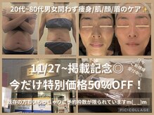 ボディリカバリー(Bodyリカバリー)