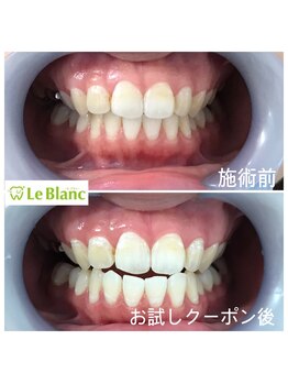 ルブラン 奈良店(Le Blanc)/マスク無しっていいですね!