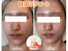 salon結(yui)の雰囲気（いつも頑張っている自分にゆったりリラックスtimeを◎）