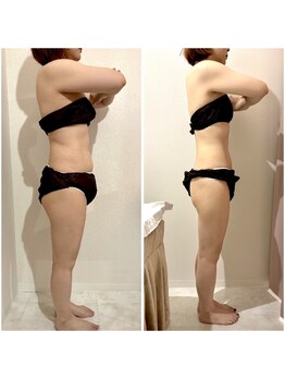 サロンドローヴ(Salon de LOAVE)の写真/関東初の大幅減量プログラム×ボディメイク痩身で見た目が激変！おサボり女性に大人気！