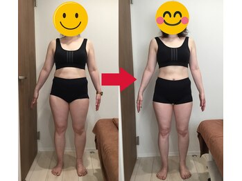 美容整体院元 光の森店/40代N.Y様のビフォーアフター