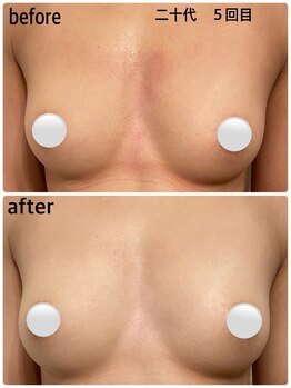 ハク 阪急茨木(HAKU)/ビフォーアフター