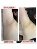 脇脱毛ならRindaへ★いきなり全身脱毛は効果が心配。。そんな方へ♪1部位◎