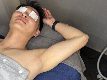 アイシス(AIsis)/メンズ脇脱毛