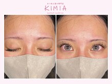 キミア(KIMIA)/フラットラッシュ140本