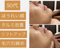 サロン ド ジョワ(salon de joie)