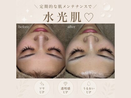 ベルスキン(Bell skin)の写真