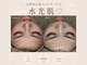 ベルスキン(Bell skin)の写真
